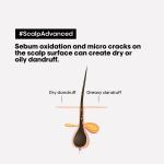 L'Oréal Professionnel Paris Scalp Advanced Anti-Dandruff Dermo-Clarifier Shampoo 300 Ml+L'Oréal Professionnel Liss Unlimited Hair Mask With Pro-Keratin For Rebellious Frizzy Hair, Serie Expert, 250Gm